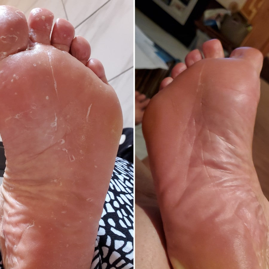 Groundwork Antifungal Cream
