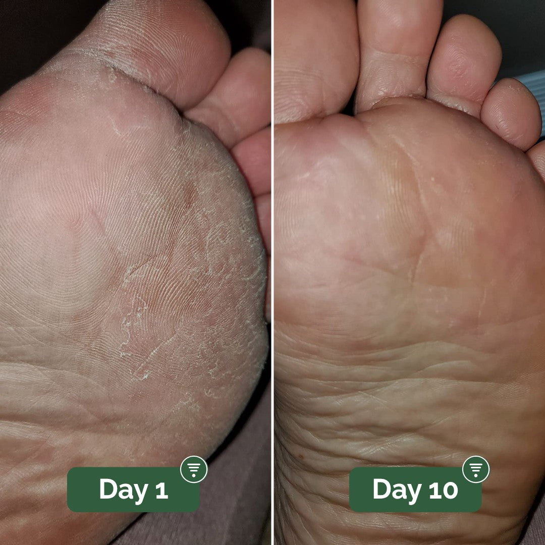 Groundwork Antifungal Cream