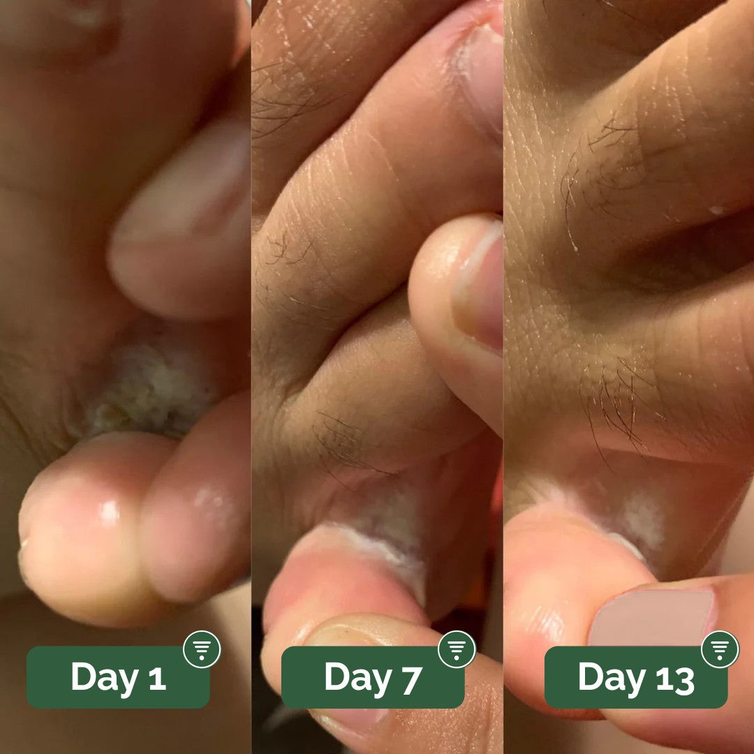 Groundwork Antifungal Cream